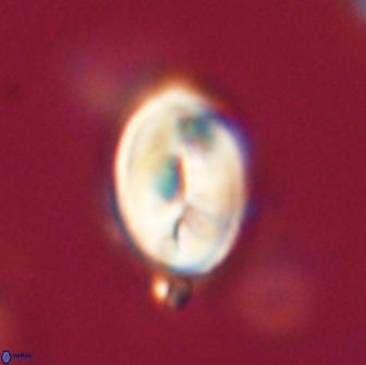 Neocrepidolithus opertus 66432