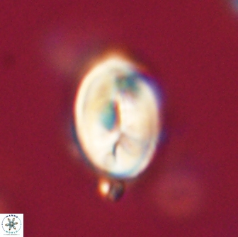 Neocrepidolithus opertus 66432