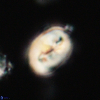 Neocrepidolithus opertus 66441