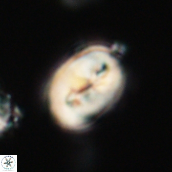 Neocrepidolithus opertus 66441