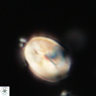 Neocrepidolithus opertus 66442