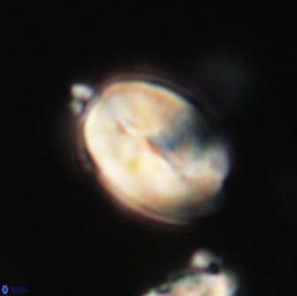 Neocrepidolithus opertus 66443