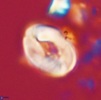 Neocrepidolithus biskayae 21064