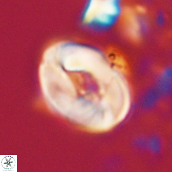Neocrepidolithus biskayae 21064
