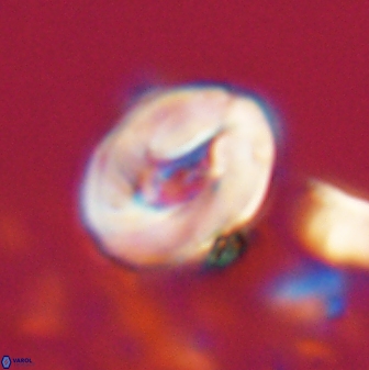 Neocrepidolithus biskayae 21069