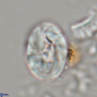 Neocrepidolithus biskayae 21071