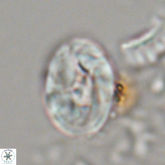 Neocrepidolithus biskayae 21071