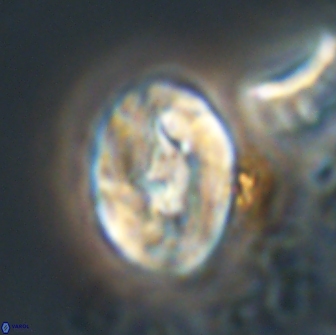 Neocrepidolithus biskayae 21072