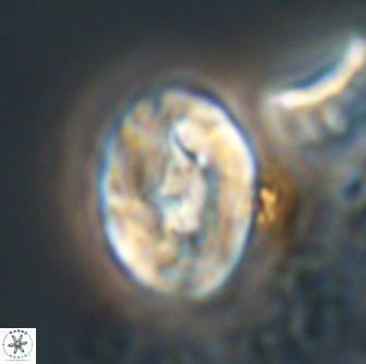 Neocrepidolithus biskayae 21072