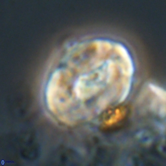 Neocrepidolithus biskayae 21073