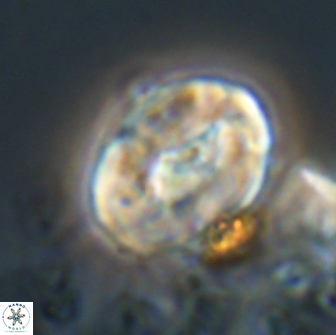 Neocrepidolithus biskayae 21073