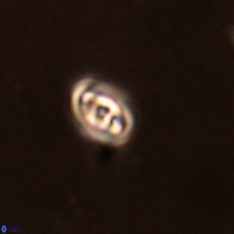 Neocrepidolithus cruciatus VR 01983