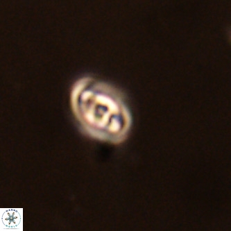 Neocrepidolithus cruciatus VR 01983