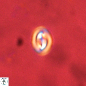 Neocrepidolithus cruciatus VR 01985