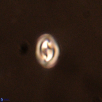 Neocrepidolithus cruciatus VR 01986