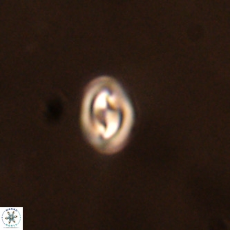 Neocrepidolithus cruciatus VR 01986
