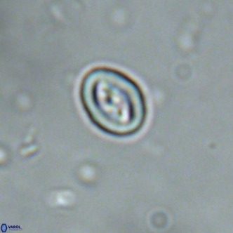 Neocrepidolithus cruciatus VR 01995