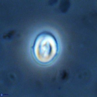 Neocrepidolithus cruciatus VR 01999