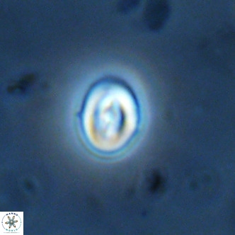 Neocrepidolithus cruciatus VR 01999