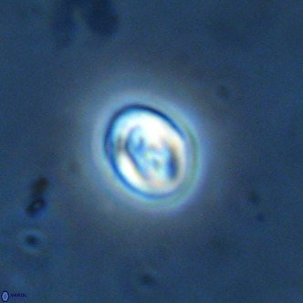 Neocrepidolithus cruciatus VR 02000