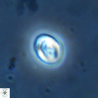Neocrepidolithus cruciatus VR 02000