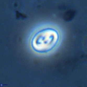 Neocrepidolithus cruciatus VR 02001