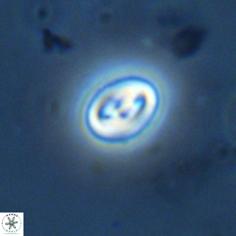 Neocrepidolithus cruciatus VR 02001