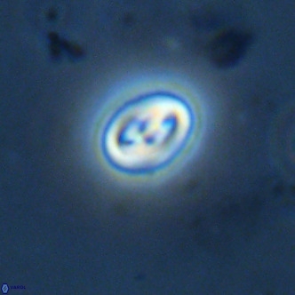 Neocrepidolithus cruciatus VR 02002