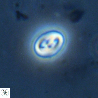 Neocrepidolithus cruciatus VR 02002
