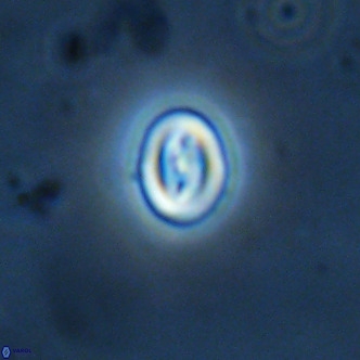 Neocrepidolithus cruciatus VR 02003