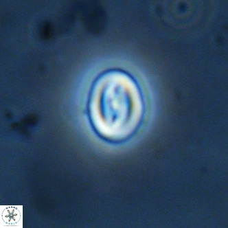 Neocrepidolithus cruciatus VR 02003
