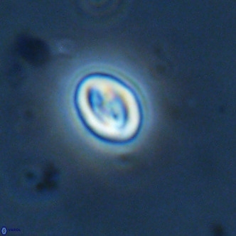 Neocrepidolithus cruciatus VR 02004