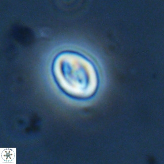Neocrepidolithus cruciatus VR 02004