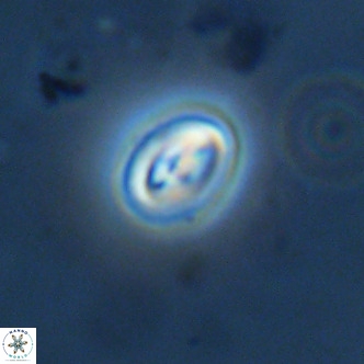 Neocrepidolithus cruciatus VR 02005