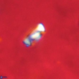 Neocrepidolithus dirimosus VR 01870