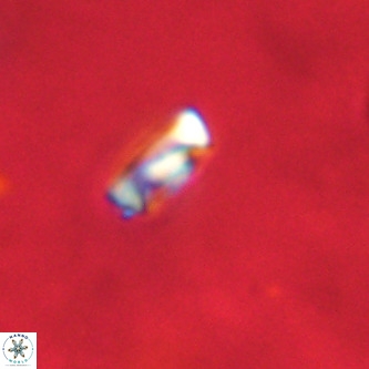 Neocrepidolithus dirimosus VR 01870