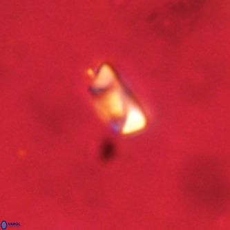 Neocrepidolithus dirimosus VR 01872