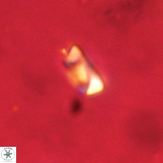 Neocrepidolithus dirimosus VR 01872