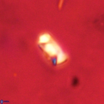 Neocrepidolithus dirimosus VR 01874