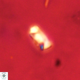 Neocrepidolithus dirimosus VR 01874