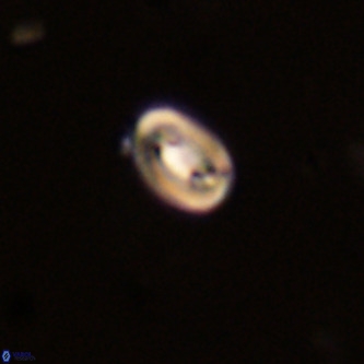 Neocrepidolithus dirimosus VR 01878