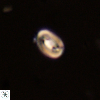 Neocrepidolithus dirimosus VR 01878