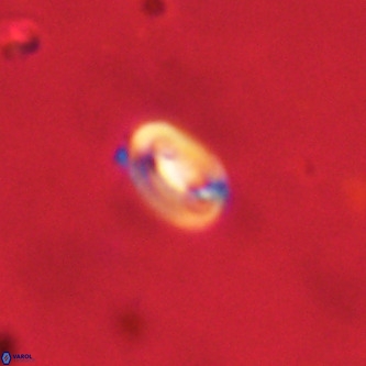 Neocrepidolithus dirimosus VR 01879