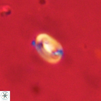 Neocrepidolithus dirimosus VR 01879