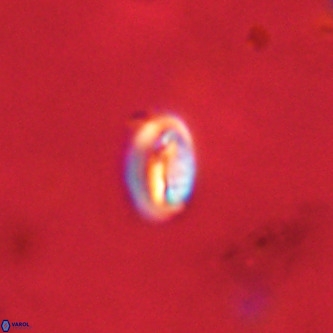 Neocrepidolithus dirimosus VR 01880