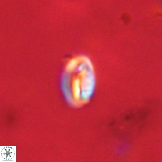 Neocrepidolithus dirimosus VR 01880