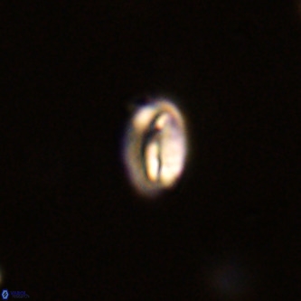 Neocrepidolithus dirimosus VR 01881