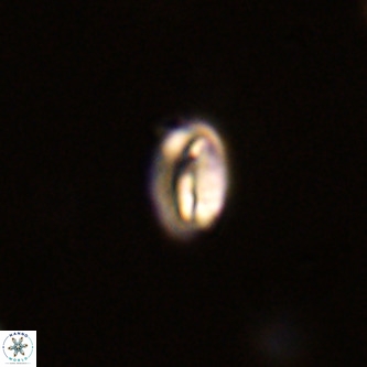 Neocrepidolithus dirimosus VR 01881