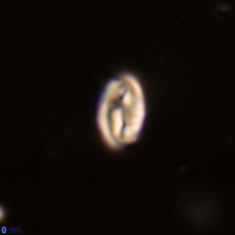Neocrepidolithus dirimosus VR 01882