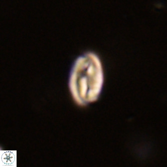 Neocrepidolithus dirimosus VR 01882